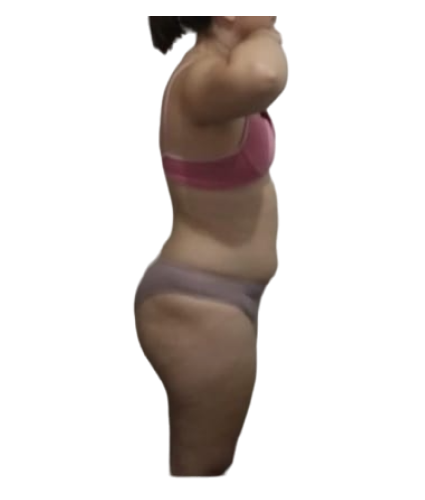 1 resultado de lado depois