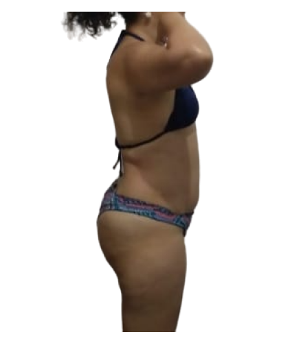 10 resultado depois