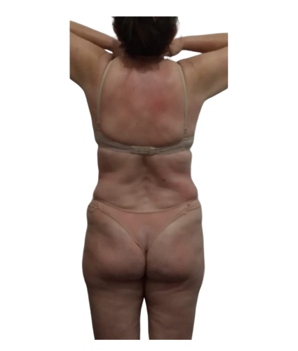 12 resultado depois