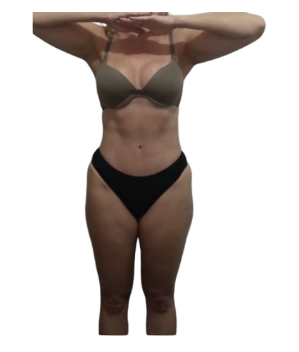 2 resultado de frente antes