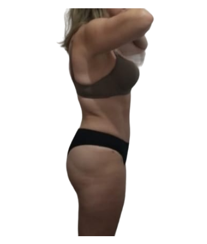 2 resultado de lado antes