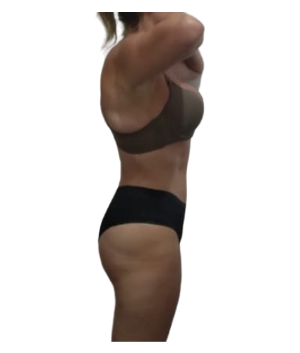 2 resultado de lado depois