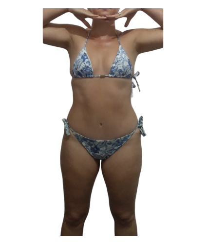3 resultado de frente depois