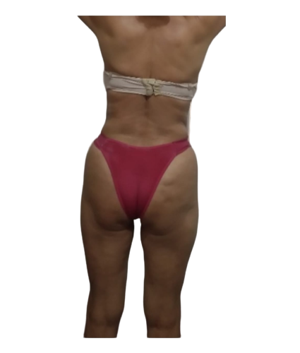 4 resultado de costas depois