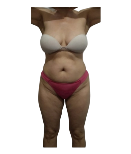 4 resultado de frente antes