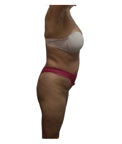 4 resultado de lado antes